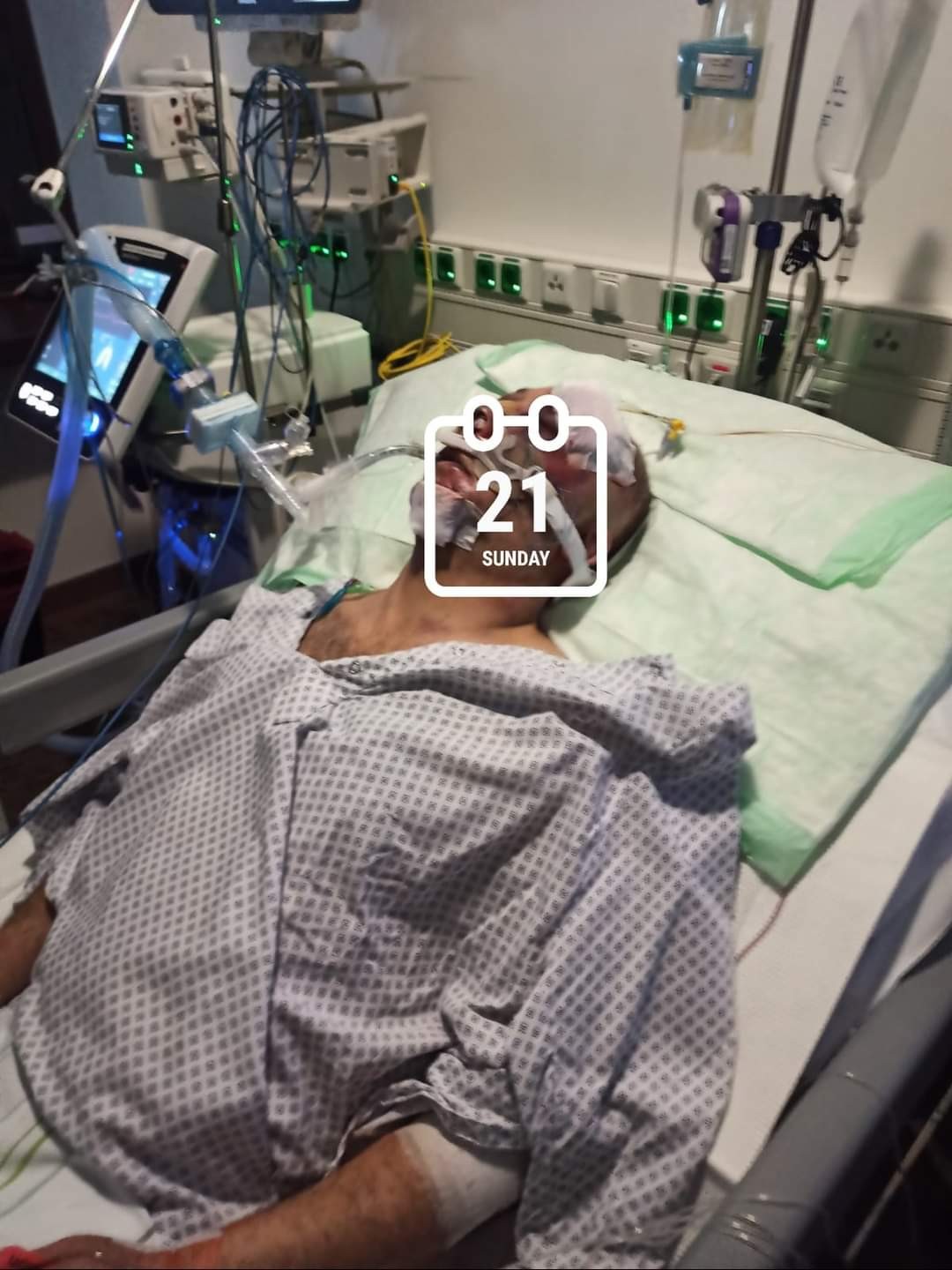 Almaniyada döyülən azərbaycanlının reanimasiyadan FOTOSU (YENİLƏNİB)